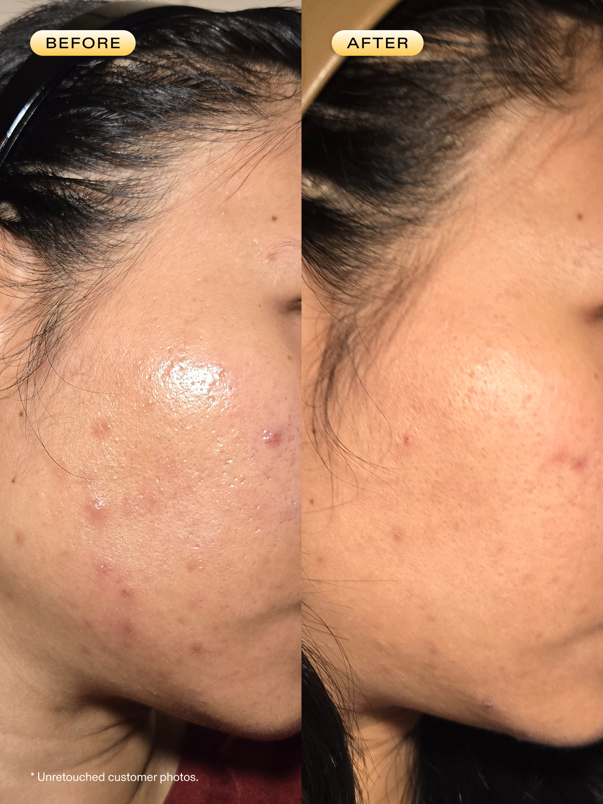 Before and after customer use 24 Carrot Retinal