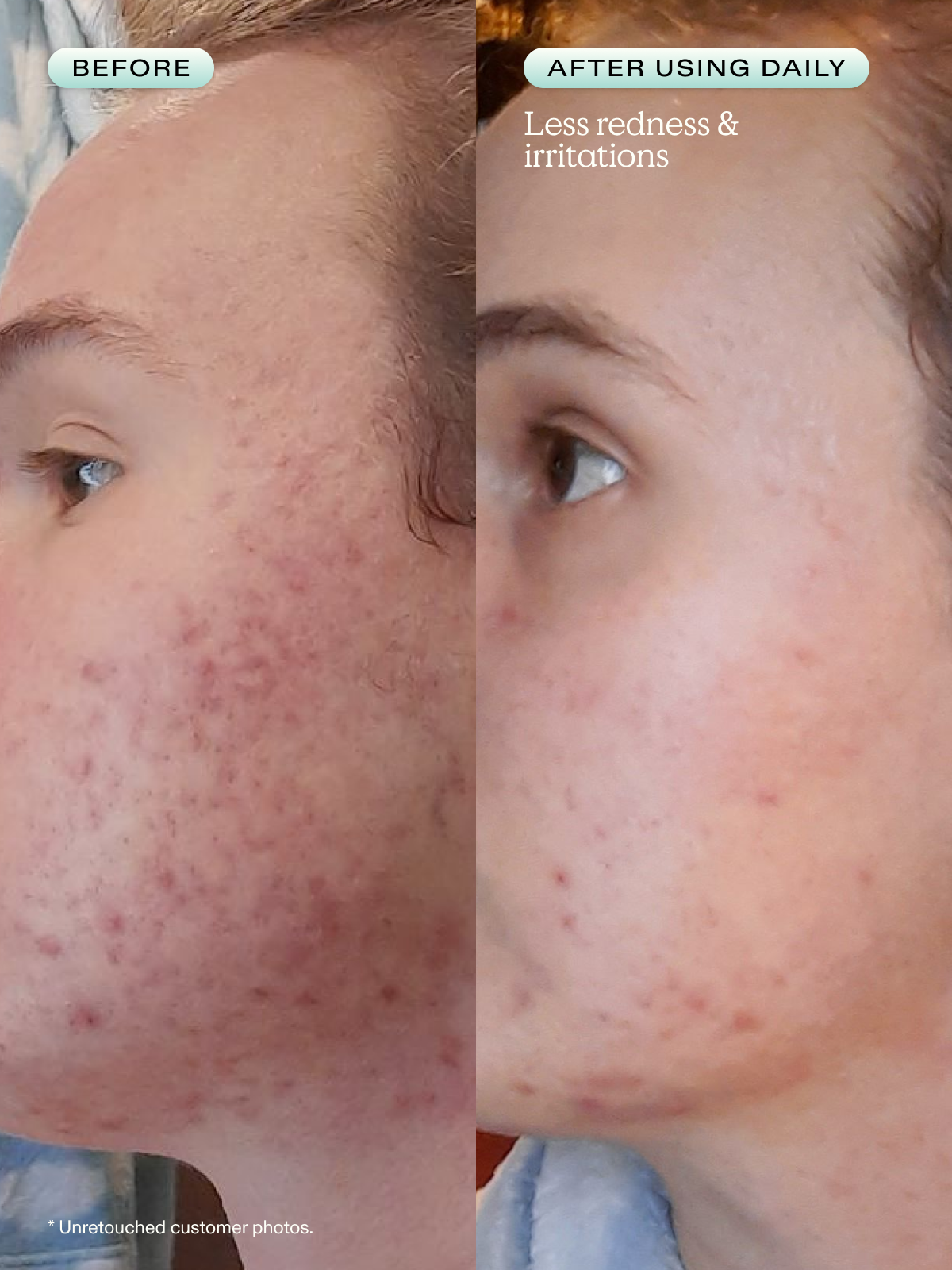 Great Barrier Relief