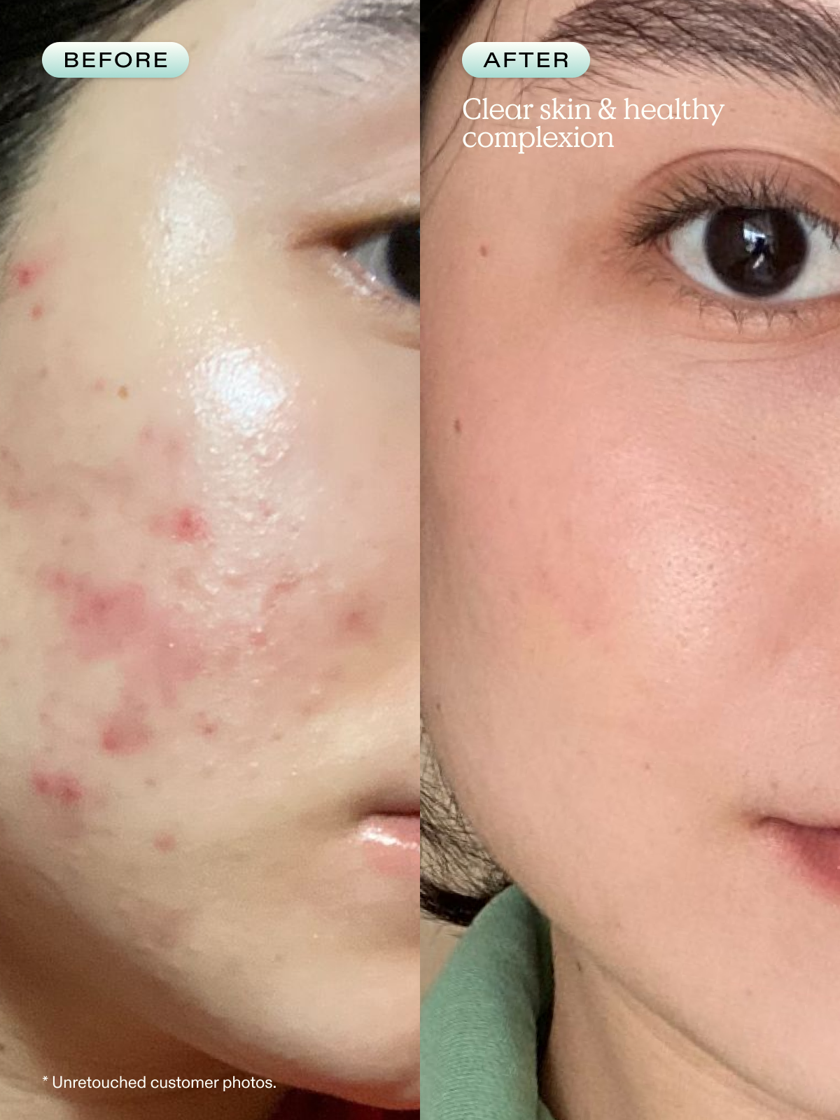 Great Barrier Relief