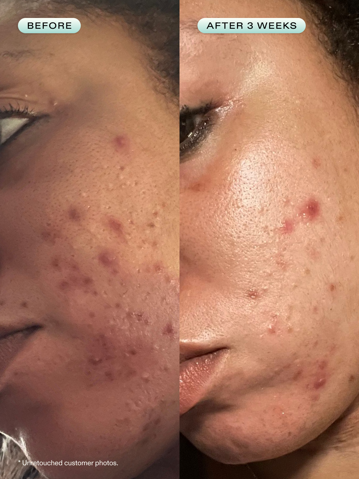 Great Barrier Relief