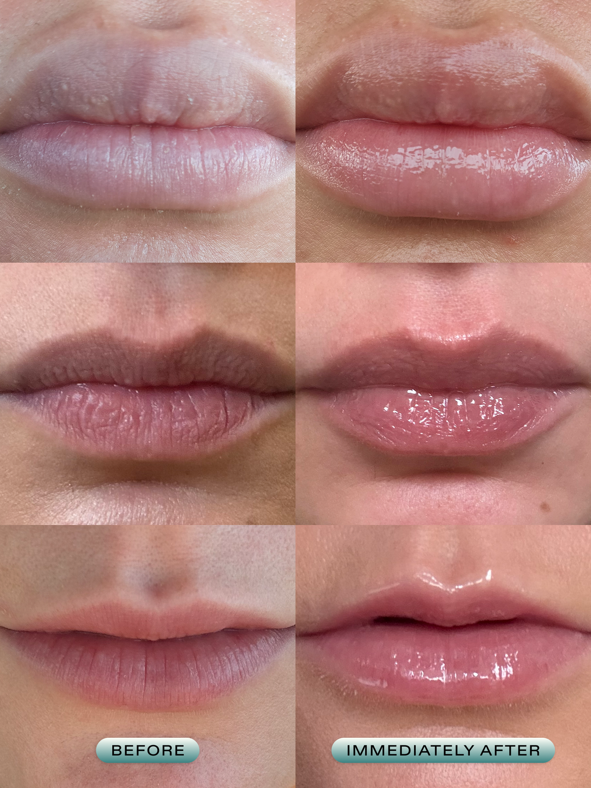 Before and immediately after wearing Lip Barrier Relief for three customers