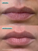 Before and after 5 days bare lips of a customer with smoother and more healthy looking lips