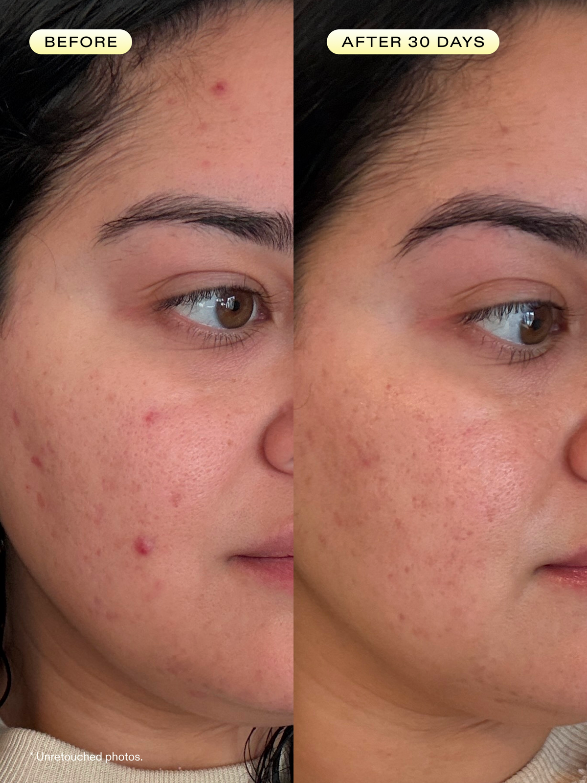 Before and after 30 days of using Oil La La