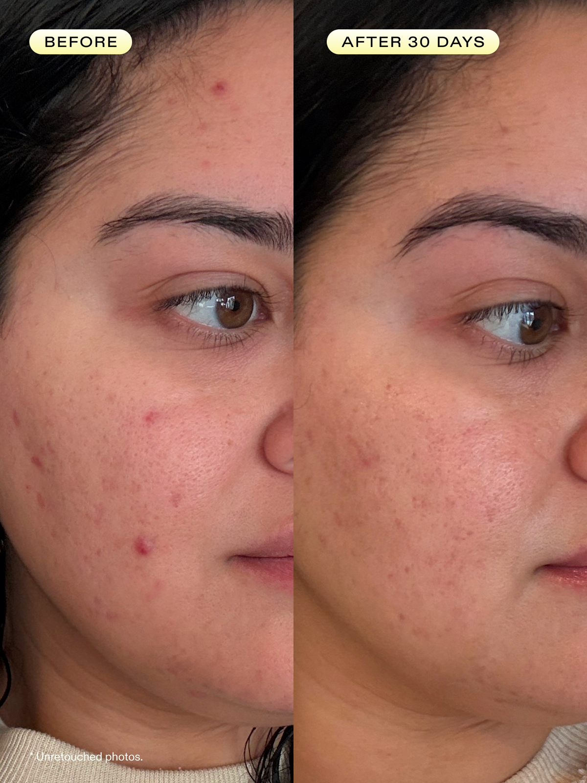 Before and after 30 days of using Oil La La