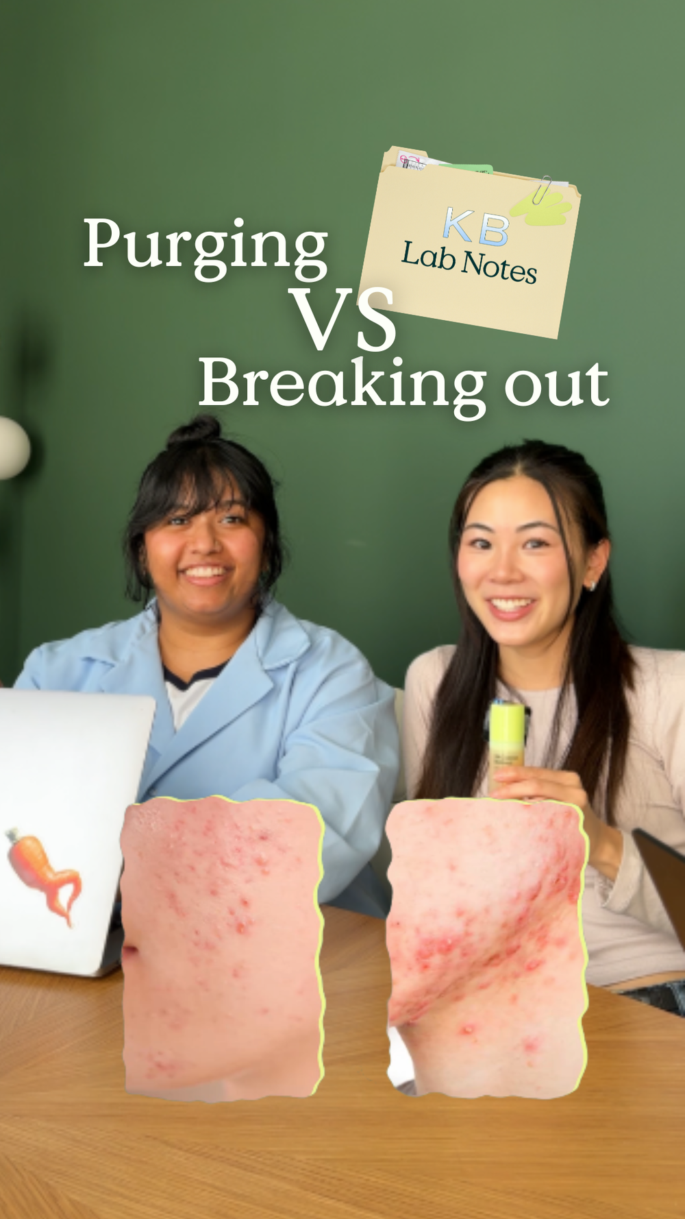 Purging vs breaking out